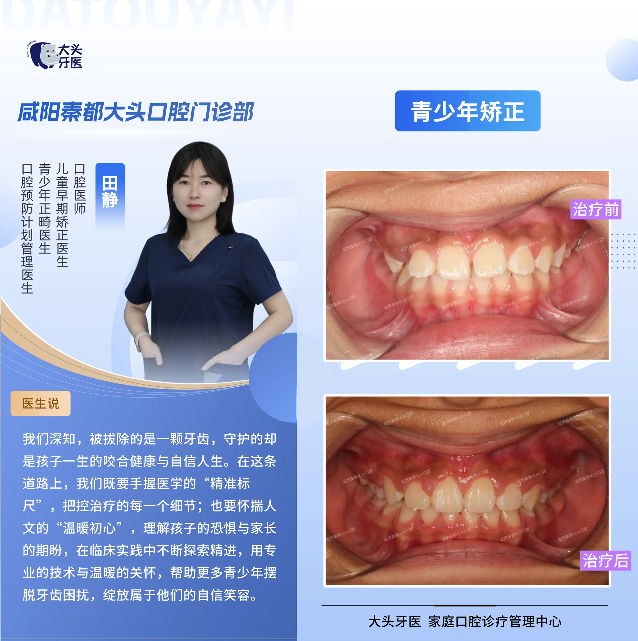 成人牙齿矫正记录