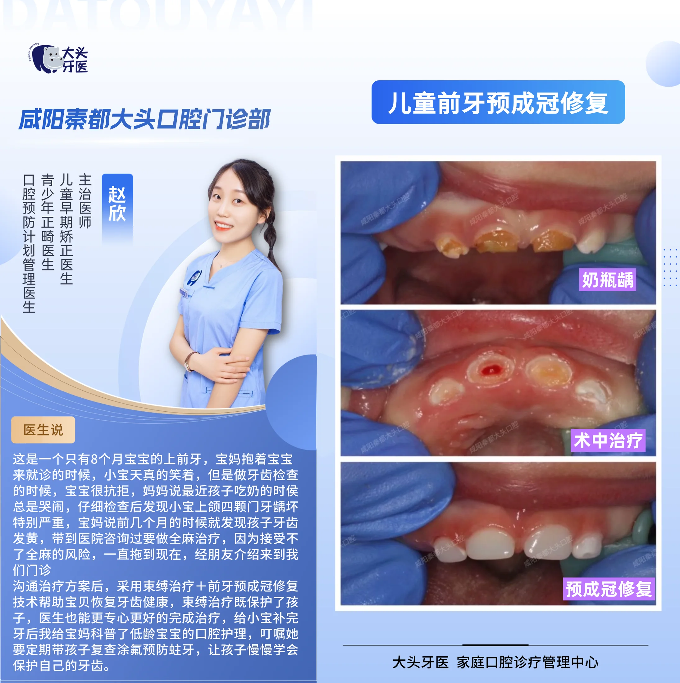 儿童龋齿综合治疗记录