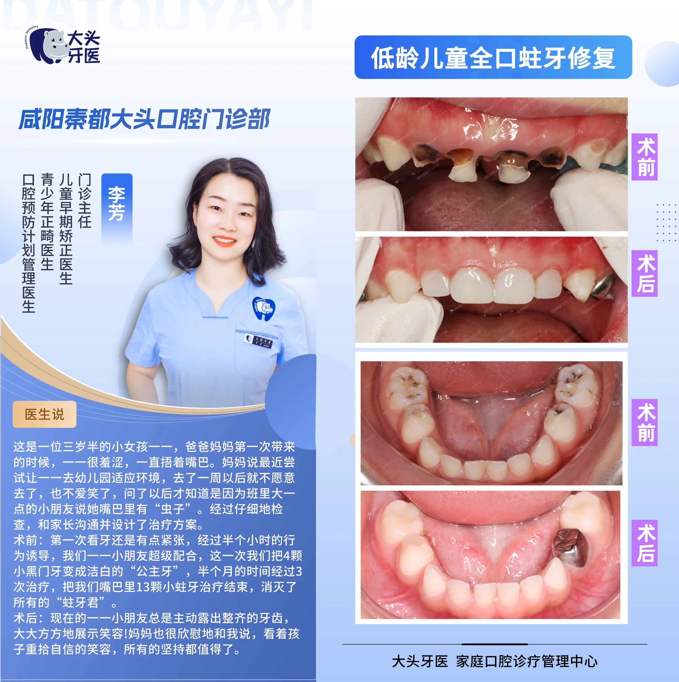 儿童早期矫治记录